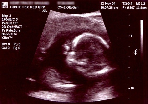 Obsteric_ultrasonograph