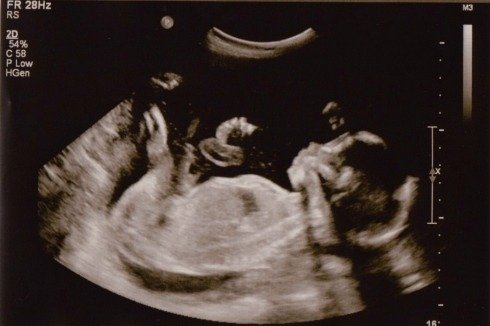 baby-1